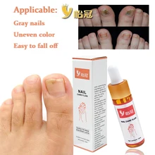 15 мл антибактериальные серые ногти Лечение Эфирное масло грибок ногтей инструменты для ремонта Уход за ногтями на ногах улучшение инфекции