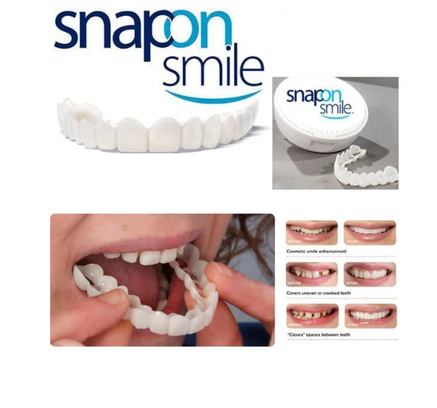 snapon Смайл имитация брекетов отбеливание зубная наклейка силиконовые инструменты для защиты ногтей Чистка зубов