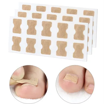 

1/2PCS Nail Strips Anti-roll Nail Free Glue Toe Inlay Nail Corrector Patch Correction Stickers Special Toenails Care Foot Care
