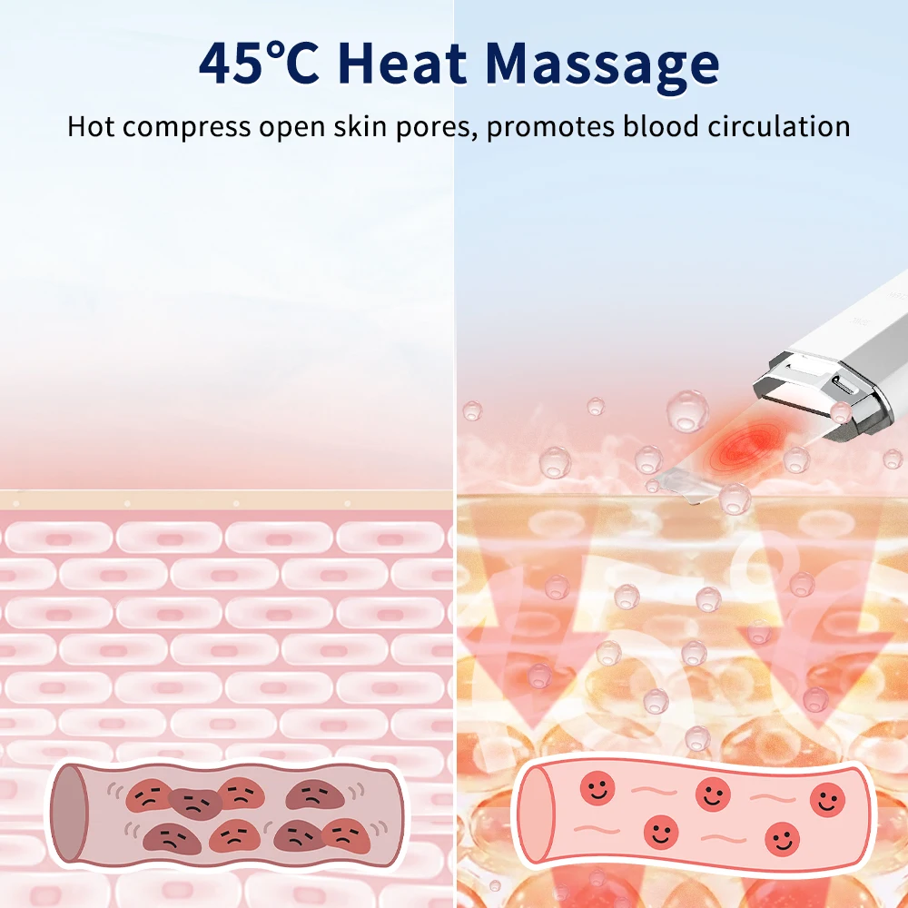 Facial Scrubber ANLAN Ultrasonic Skin Scrubber Ion Deep Face Cleaning 45℃ Heat EMS Facial Lifting Ultrasonic Cleaner Peeling Skin Care Device