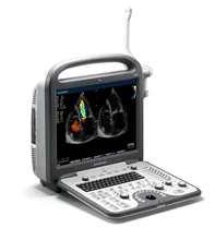

Portable Color Doppler Ultrasound Machine Cardiology Scan