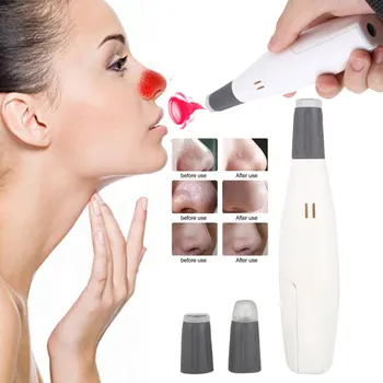 

Facial Skin Care Blackhead Remover Pore Vacuum Suction Acne Peeling Pore Face CleanserDiamond Microdermabrasion Beauty Machine