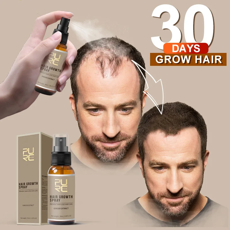 30ml PURC Unisex Hair Growth Spray Extract Prevent Loss Growing Natural Plant Essence Liquid Care Product TSLM1 | Красота и здоровье