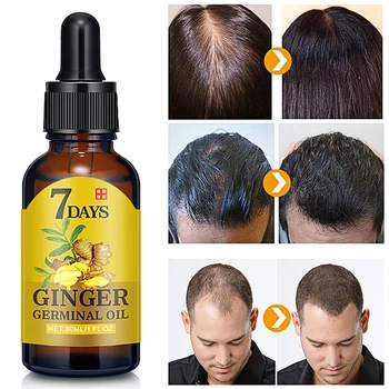 

7 Days 30ML Effective Hair Growth Ointment Hair Care Healthy Hair Growth Essence Oil Damaged Hair Nutrition Ginger Hair lotion