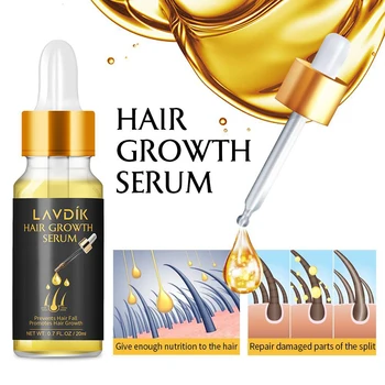 

LAVDIK Ginger Fast Hair Growth Serum Essential Oil Anti Preventing Hair Lose Liquid Damaged Hair Repair Growing Women Men TSLM1