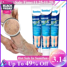 3pcs Varicose Veins Treatment Cream Vasculitis Phlebitis Spider Ointment Varicosity Angiitis Removal Herbal Medical Plaster 20g