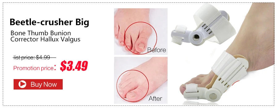 Hallux Valgus Orthotics Big Toe Corrector Foot Pain Relief Feet Care Bone Bunion Corrector Night And Day Used Splint Pedicure