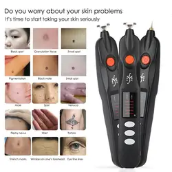USB Electric Magic Pen Freckle Wrinkle Scar Tattoo Multifunctional Electric Ion Carbonation Function Beauty Skin Care Instrument
