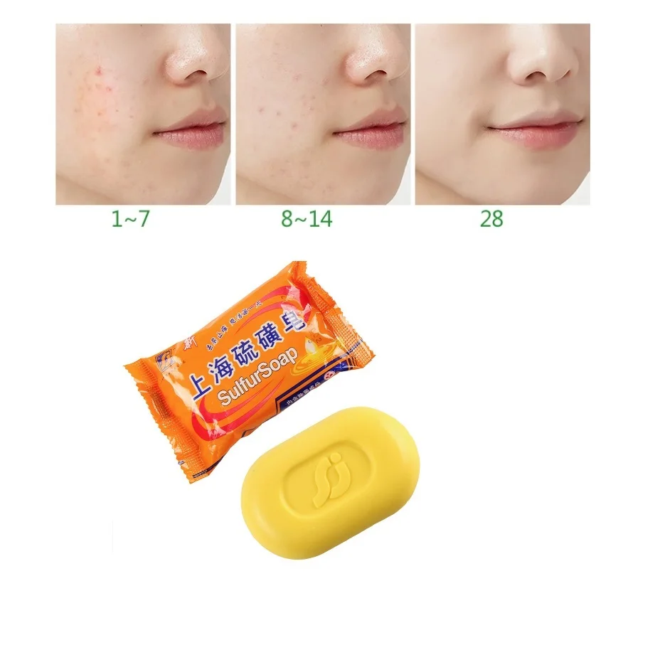 1pc 85g Shanghai sulfur soap oil-control acne treatment blackhead remover soap Whitening cleanser Chinese traditional Skin care