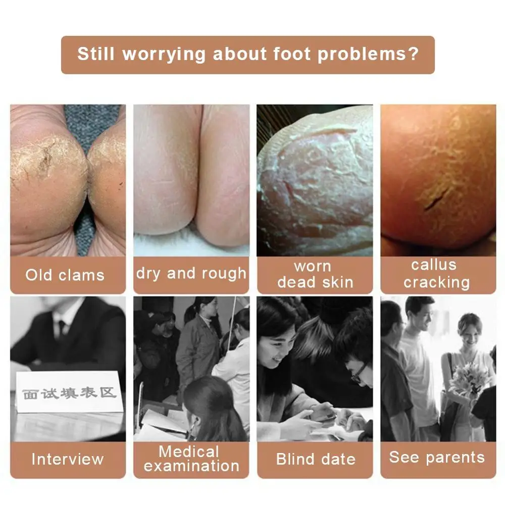 2.5cm Invisible Height Lift Heel Pad Sock Liners Gel Insole Heel Protector Relieve  Foot Pain Cracked Foot Skin Care Tool