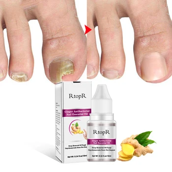 

10ml Anti Fungus Non Infection Essence Universal Care Medicinal Portable Repair Toe Nail Treatment Remedy Finger Nutritious