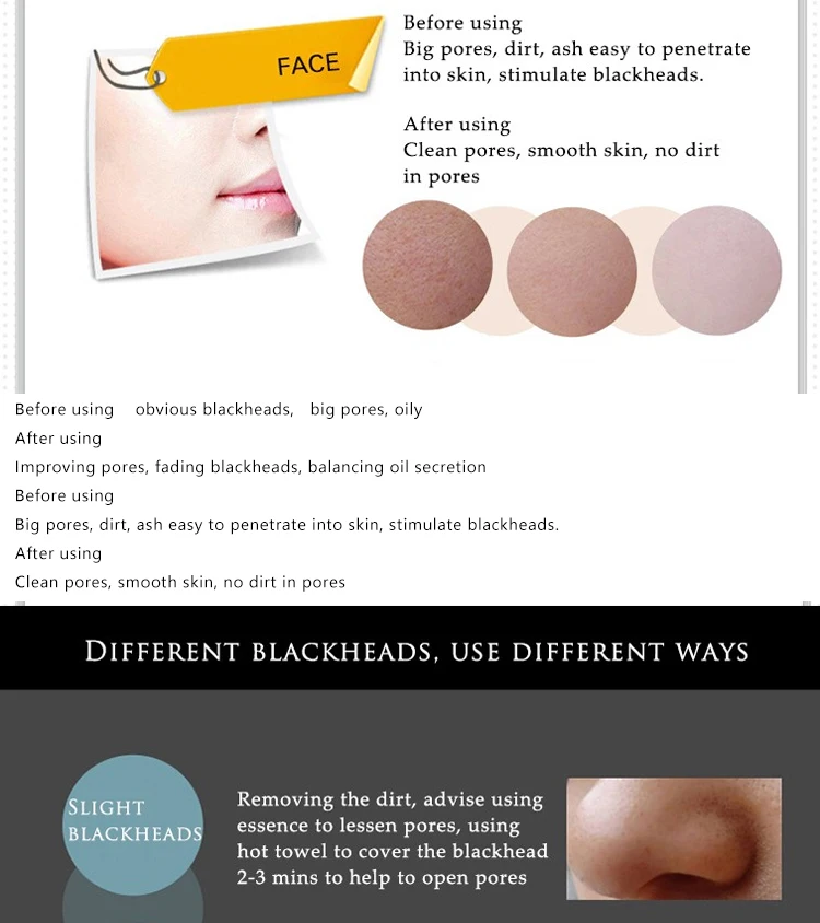 Blackhead удаление Глубокая чистка Очищающая акне Черная грязевая маска для лица, 1 шт