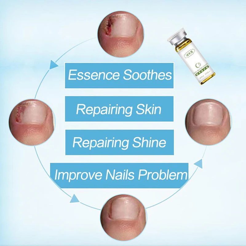 Nail Repair Liquid Herbal Care Treatment With File Foot Nail Anti Remove Nail Onychomycosis Fungus Toe 2