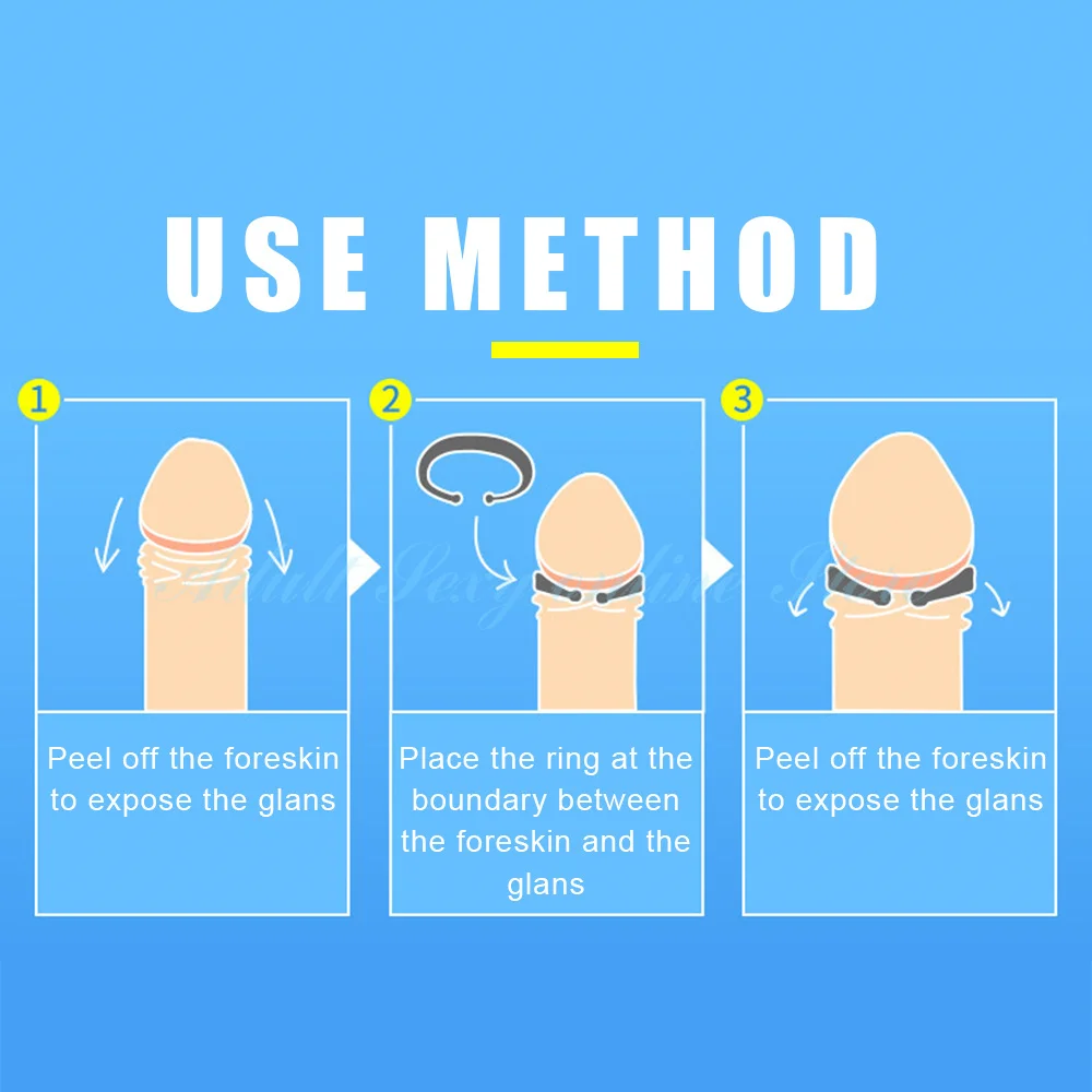 Foreskin Corrector Cock Ring Penis Stretcher Resistance Ring Sex Toys 2PCS/Set male sex toys for Men