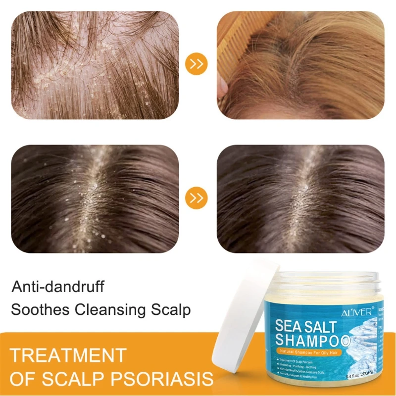 Natural Sea Salt Shampoo Hair Treatment Shampoo For Scalp Psoriasis Itching - Shampoos - AliExpress