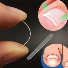 10 шт., прозрачные наклейки для коррекции ногтей, упругие накладки для ухода за ногами, педикюр, выпрямление, инструмент для лечения пароникьи, восстановление