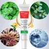 Acne Treatment Face Cream Scar Blackhead Remover Repair Gel Oil Control Shrink Pores Whitening Skin Care Korean Cosmetics ► Photo 3/6