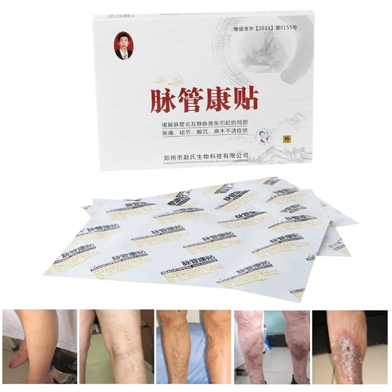 Chinese Herbal Varicose Veins Treatment Patch Leg Acid Bilges Old Bad Leg Patch