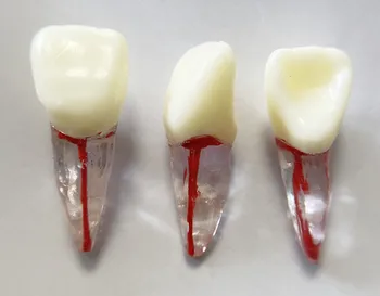 

Teach Tool 21# Front Anterior Teeth Endo File Blocks Canal Pulp Files Tooth Dental School Practise Dentist Study Model