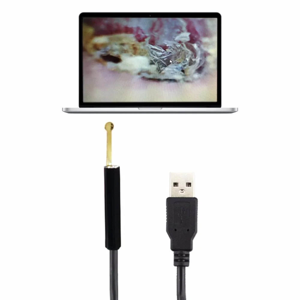 Многофункциональный P110 мини USB для чистки ушей набор для эндоскопии 5,5 мм объектив с HD пикселей для чистки ушей палочка для ушей уши электростимулятор для поддержания