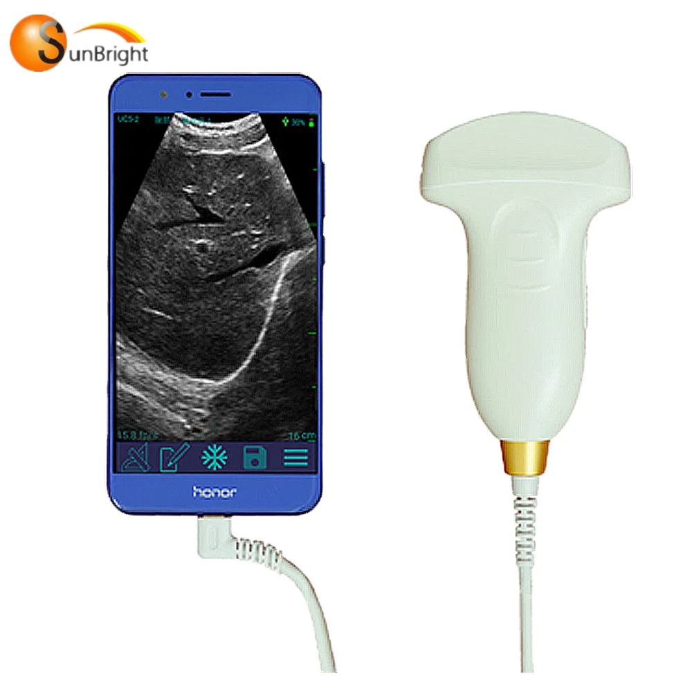 Pocket Size Portable Wireless And Usb Ultrasound Probe Machine Convex Linear Scanner - Tool Parts - AliExpress