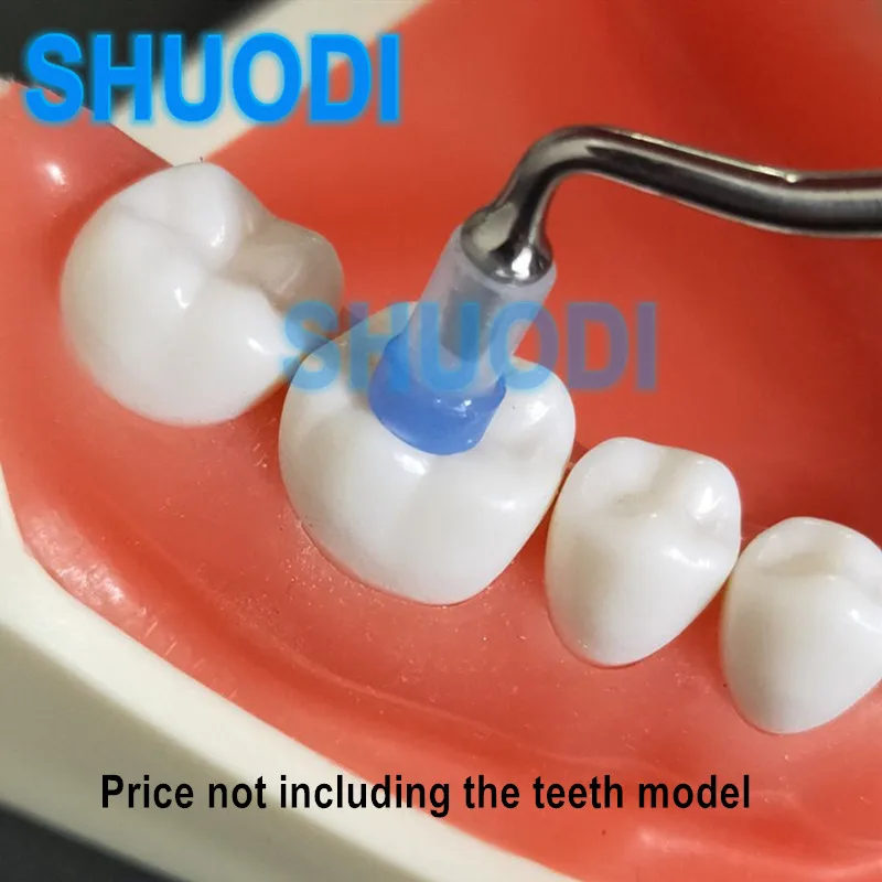 Composite Resin Dental Filling Cost Fabulous Collection www.meesenburg.kz