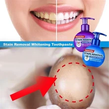 Удаление пятен отбеливающая зубная паста борьба с кровотечением Десен Зубная паста Чистка зубов, уход за полостью рта отбеливающий пресс