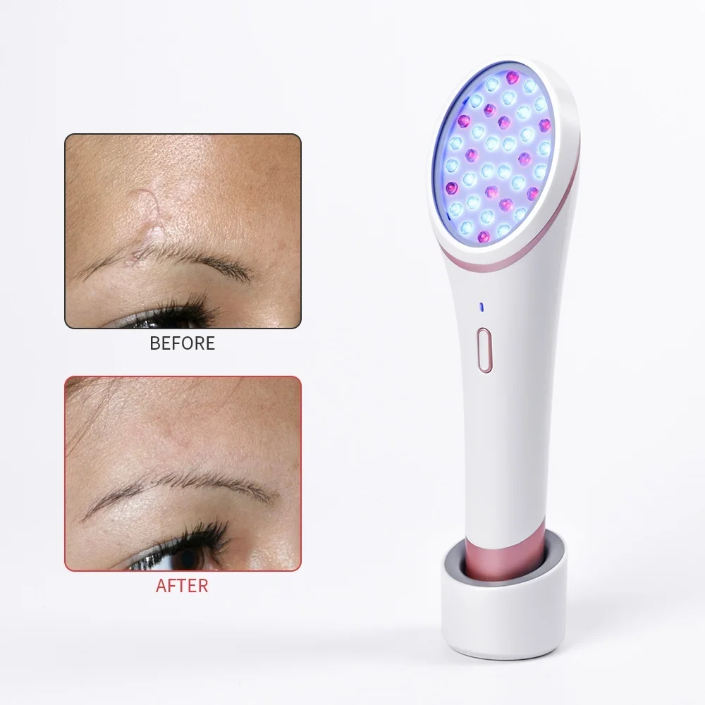  VIP LED Photon Skin Rejuvenation - 4000527651155