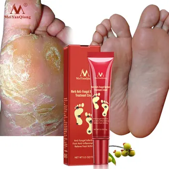 

Herbal Foot Treatment Anti Fungal Infection Onychomycosis Paronychia Effective Toe Fungus Treatment Feet Repair Cream foot care5