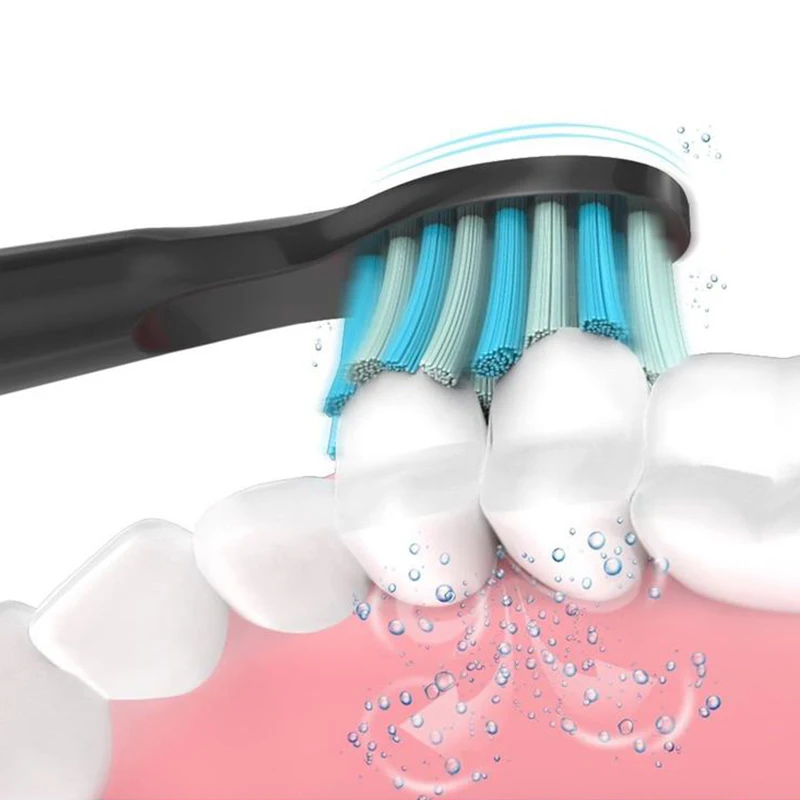 Сменные насадки для зубной щетки Sonicare набор звуковой гигиены (5 головок) Alfawise So White