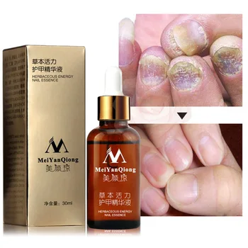

30ml Herb Nail Repair Essence Serum Care Foot Nail Fungus Removal Gel Anti Infection Paronychia Onychomycosis Treatment Foot Car