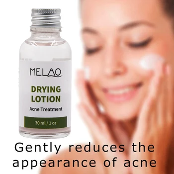 

Effective Acne Treatment Drying Lotion Anti Acne Serum Pimple Blemish Removal Face Serum 39ml