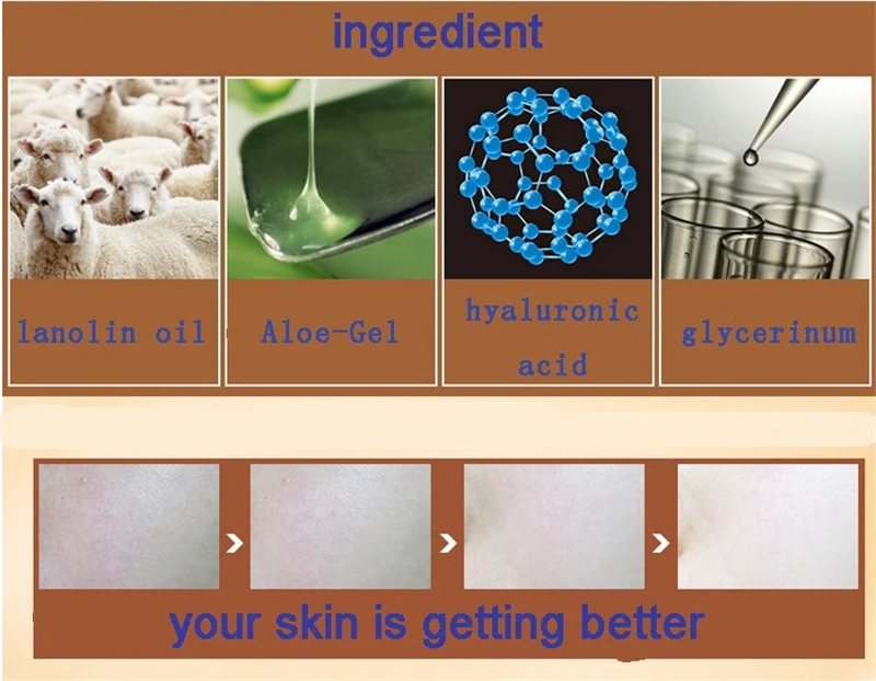 HTB1h.88KpXXXXXIXFXXq6xXFXXXo