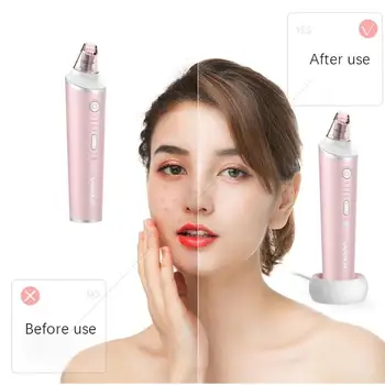 

Electric Facial Cleansing Brush Mini Facial Cleansing Apparatus Blackhead Acne Dirt Removal Massage Tool Face Skin Care Massage