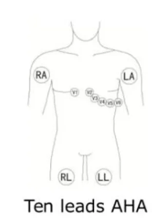 Замена кабеля EKG 10-lead для Esaote Archimed 4120, personal C1, personal C3
