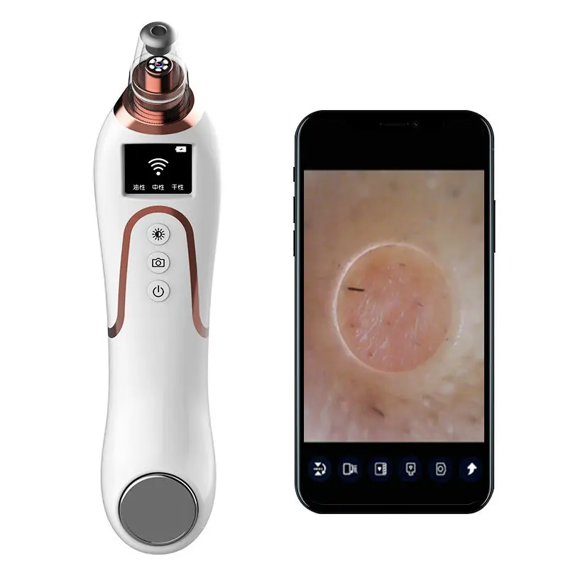 

Wireless WiFi Visual Blackhead Remover Vaccum 1080P HD with LED Light and Adjustable Suction Force for All Skin Treatment