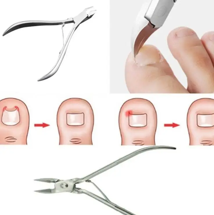 Профессиональный каблук из нержавеющей стали Маникюрные щипчики для ногтей резак вросших педикюра Инструменты кусачки для удаления вросшего ноготя инструмент для ухода за ногами