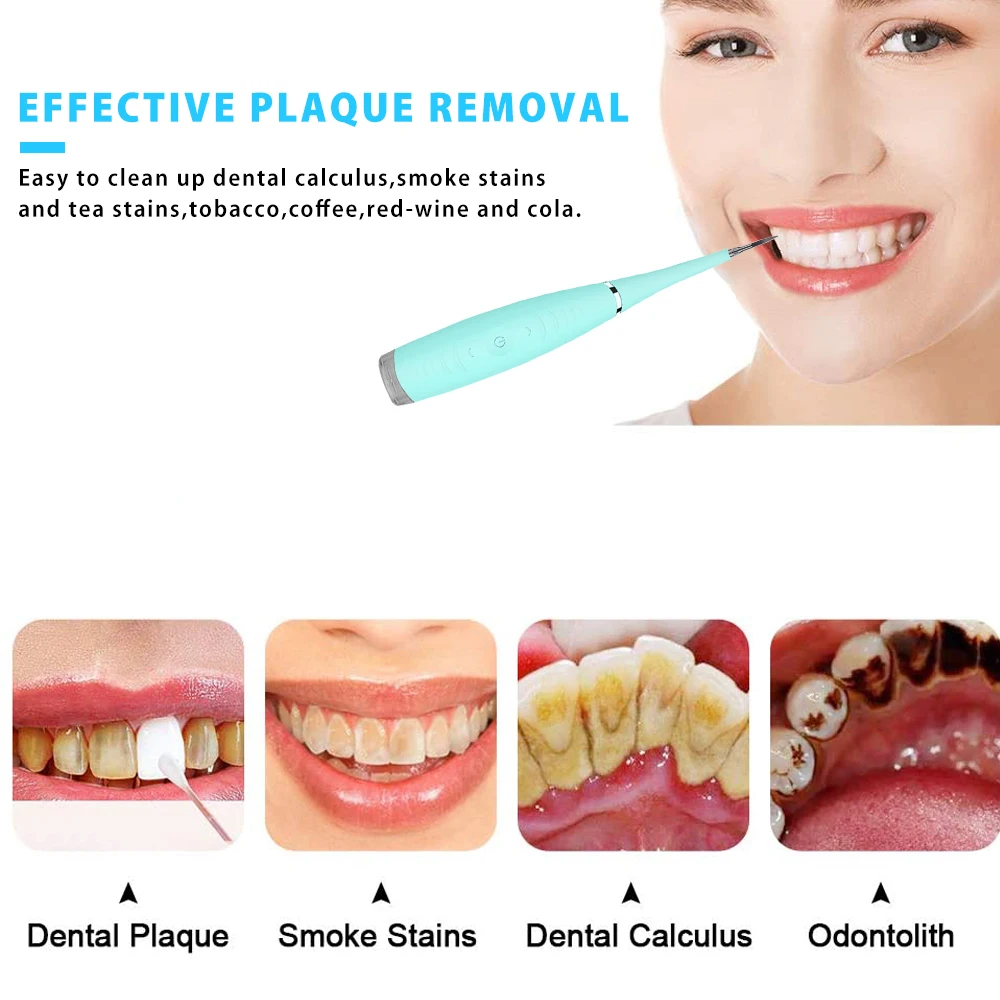 Зубной скалер Sonic Dental Scaler инструмент для удаления зубного налета чистки языка