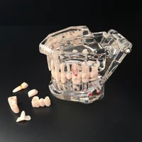 Nowy Model dentystyczny Implant zębów przywrócenie mostu nauczanie studium medycyna nauka choroba dentysta stomatologia produkty 1