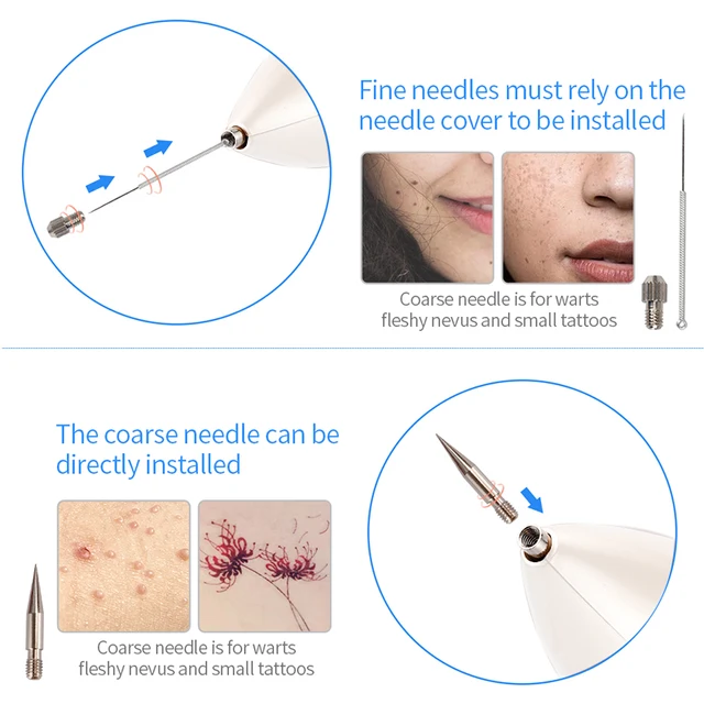 Mole Removal Dark Spot Skin Wart Tag Tattoo Removal Flawless Skin Appearance Laser Plasma Pen 5