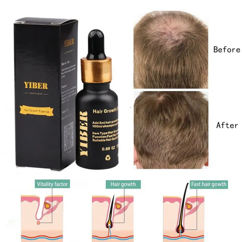 Уход за волосами для роста волос Эфирные масла эссенция оригинальный подлинный 100% выпадение волос жидкость для здоровья красивые, густые