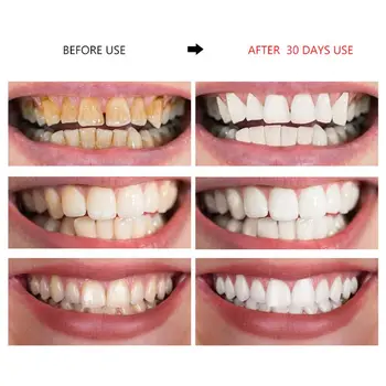 

Teeth Whitening Mousse Toothpaste Tooth Cleaning Fresh Shining Green Tea Extract 896D