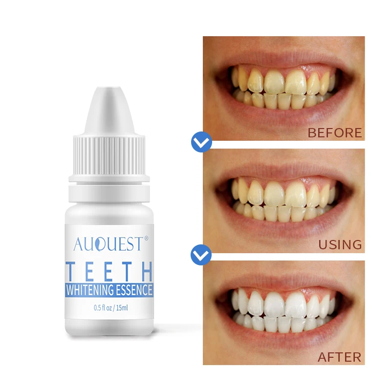 牙齿美白800x800-6