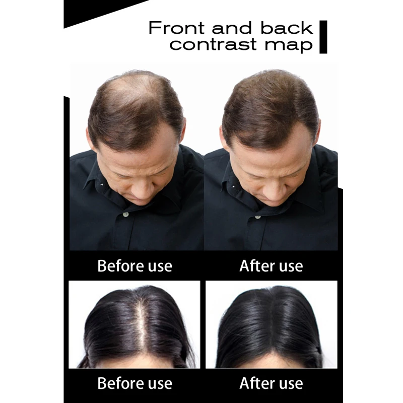 Полный волос Мгновенно волосы строительные волокна для мужчин и женщин средство против выпадения волос скрывающий порошок 27,5 г