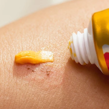 

Hot selling 20PIECE YIGANERJING Skin Psoriasis Cream Dermatitis Eczematoid Eczema Ointment