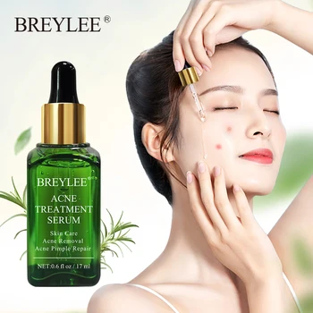 

BREYLEE 17ml Acne Treatment Face Serum Mask Anti Acne Pimple Scar Remover Moisturizing Whitening Skin Care Facial Essence Cream