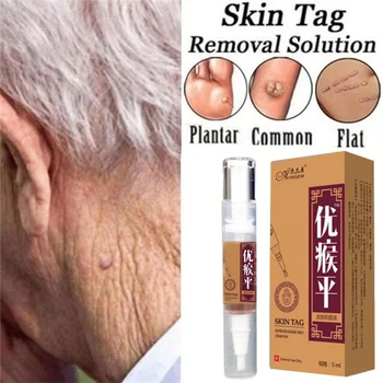 

5ml Plantar Wart Remover Corn Callus Remover Natural Removal Liquid Pen Stops Regrowth Care E1