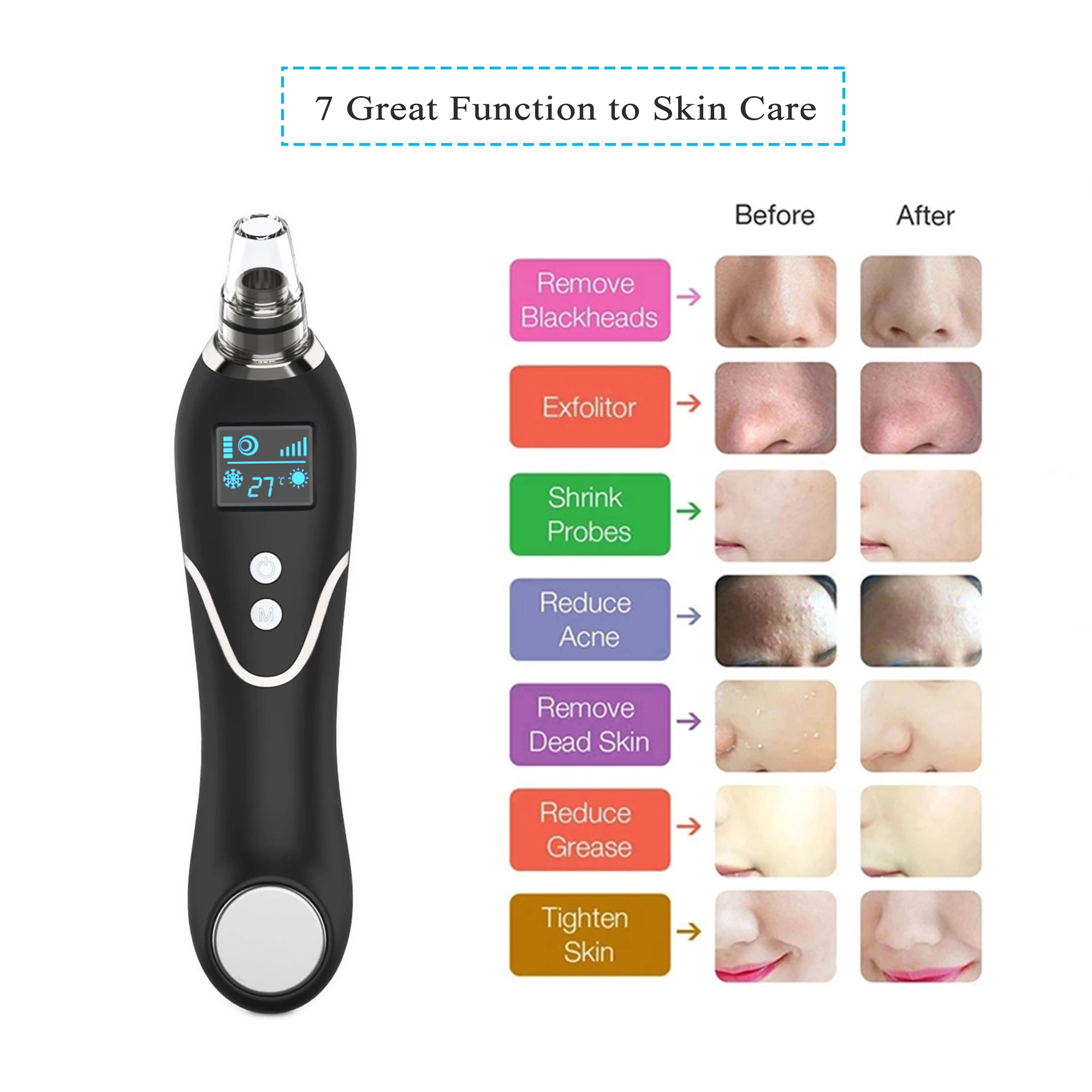 US $30.35 Blackhead Remover Hot Cold Facial Cleaner Deep Pore Acne Pimple Sucker Acne Extractor Removal Vacuum Suction Face SPA Skin Care
