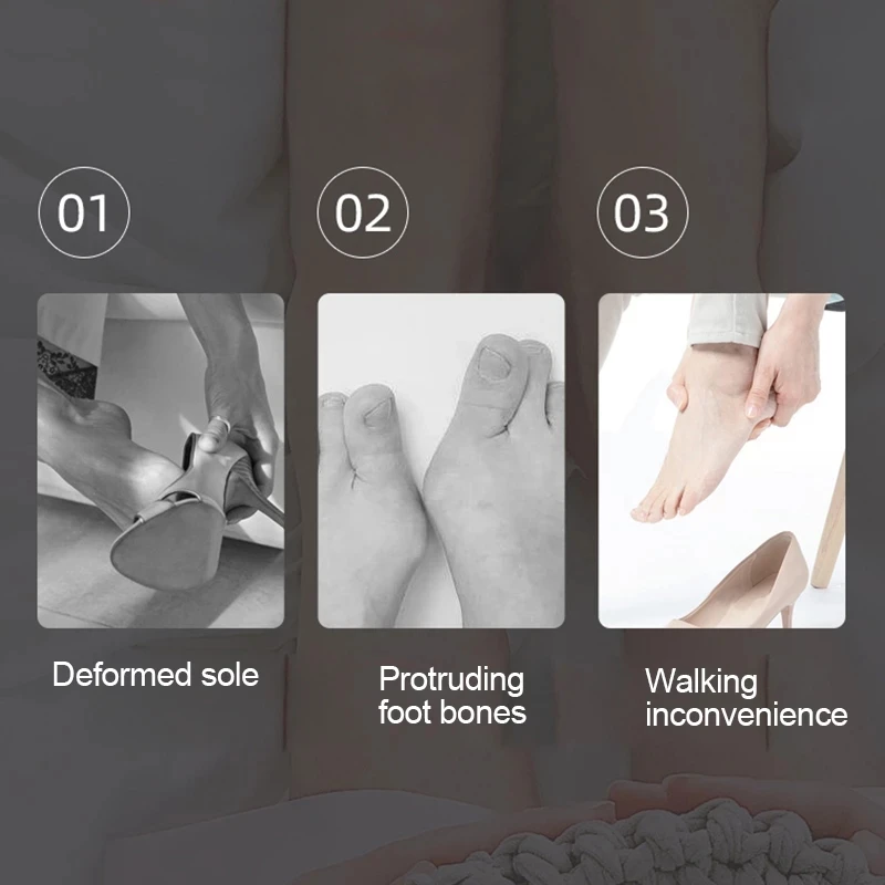 2pcs = 1pair Soft Gel Toe Separator Spacers For Bunion Corrector Overlapping Toe Straightener Foot Care Tool Protective Stretchers toe separators toe corrector toe spreader finger toe separator toe protectors
