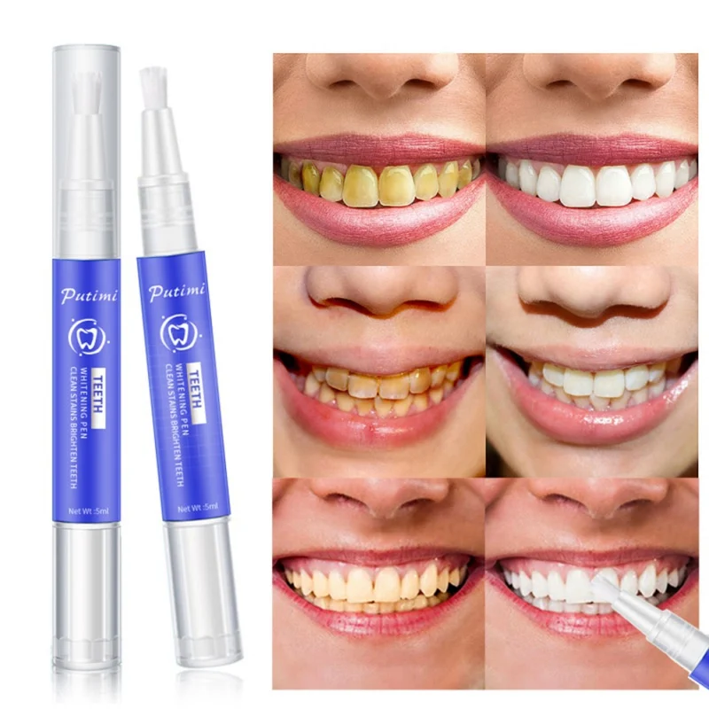 Teeth Whitening Pen Tooth Care Remove Black For Smoke Stains Tea Stain Removal Plaque |